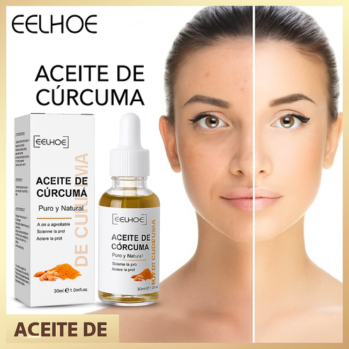 Aceite Esencial de Cúrcuma